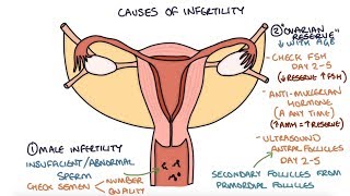 Understanding Infertility Causes and Investigations