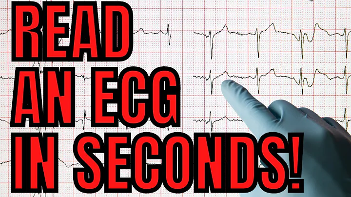 How to Read an ECG as a NEW ER Nurse : Looking for Signs of Ischemia and certain Dangerous Rhythms !