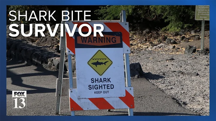 Utah man survives after being bitten by shark in Hawaii