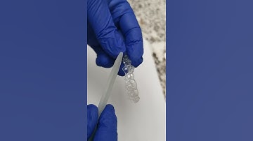 How To Smooth Rough Edges on Invisalign Aligners in Toronto