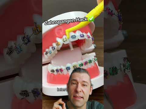 Zahnspangen Hack #shorts