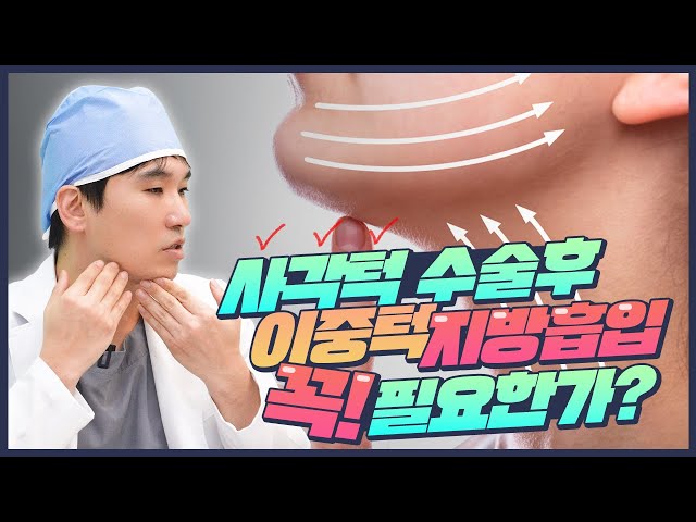 사각턱수술 해도 효과가 없으면 지방흡입을 같이 해야됩니다 | 에이비성형외과