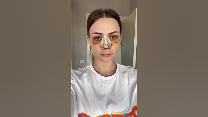 Burun ameliyatı olmak isteyenleri görelim 😃😃😃