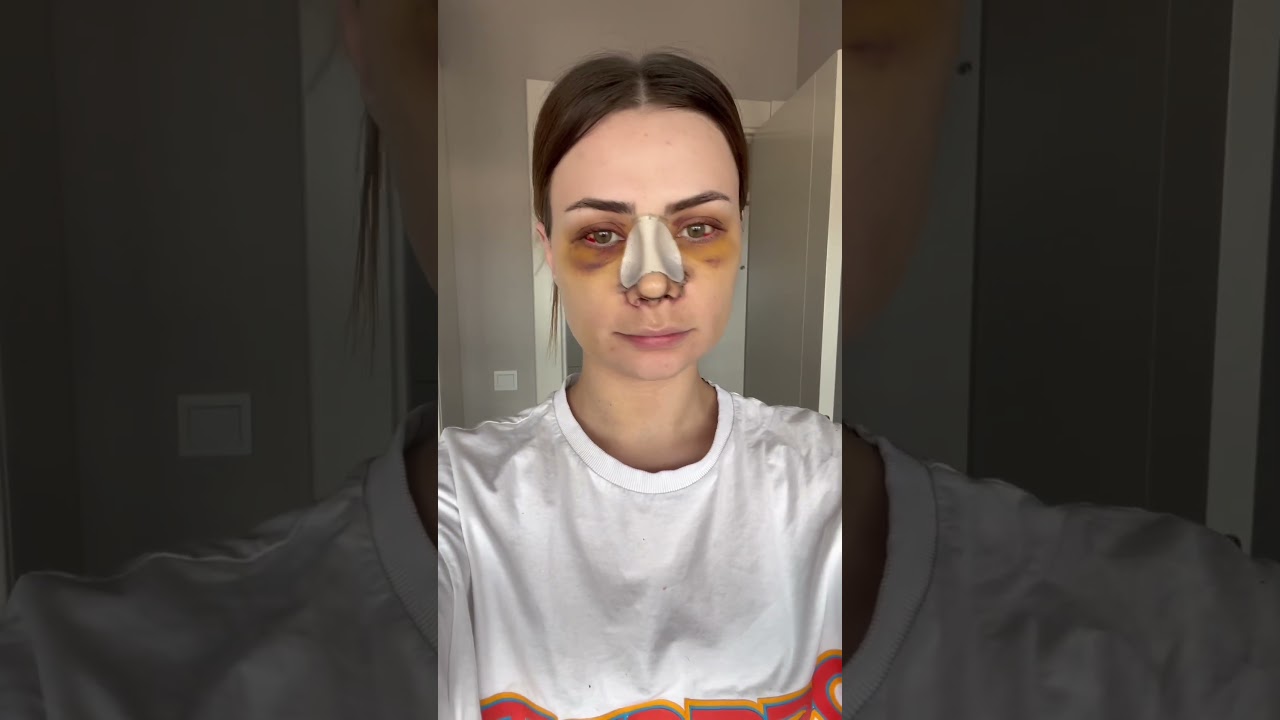 preview_player