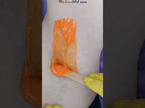 Orange wax-armpit waxing for short hair with @elenazaitsevadepilprof