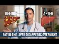 An 85‑Year‑Old Doctor Shocked Colleagues: How Liver Fat Melts Overnight