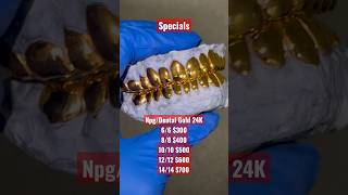 Check out our Quality and Specials we are running‼️ “Everythang Glee” #glee #gold #grillz #florida
