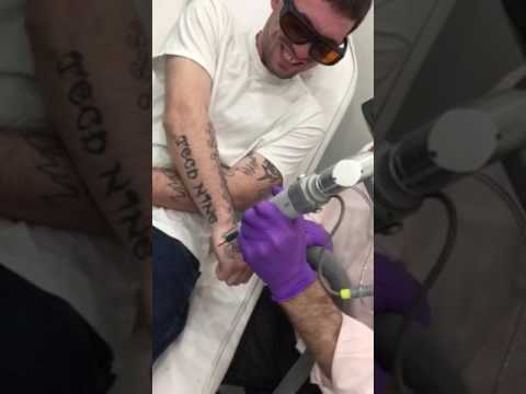 laser tattoo removal at bare tattoo u0026 hair removal in chicago laser tattoo removal at bare tattoo u0026 hair removal in chicago