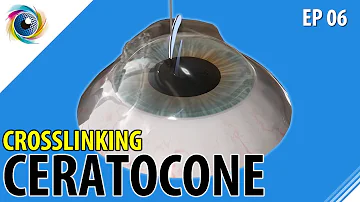 Como é feito o Crosslinking?
