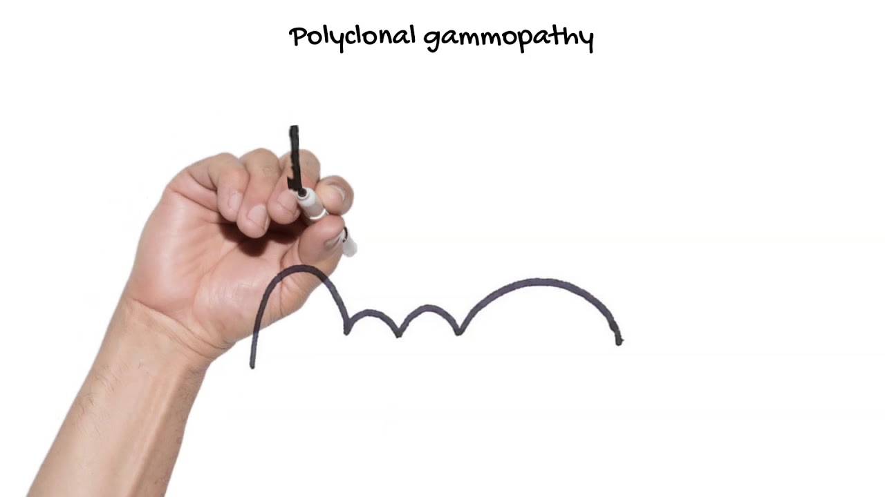 Protein electrophoresis Vet students YouTube
