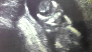 COMING SOON! 2012 TEASER