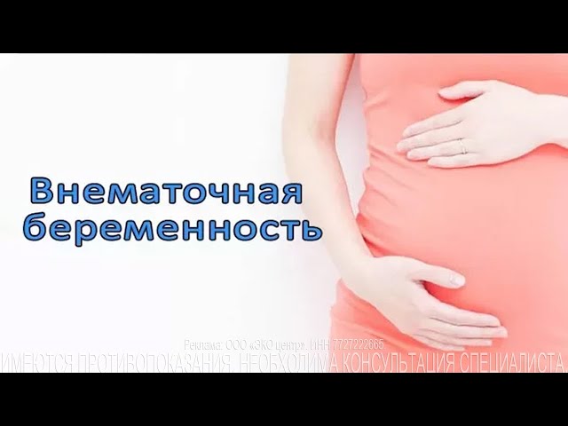 Внематочная беременность. Симптомы и факторы.