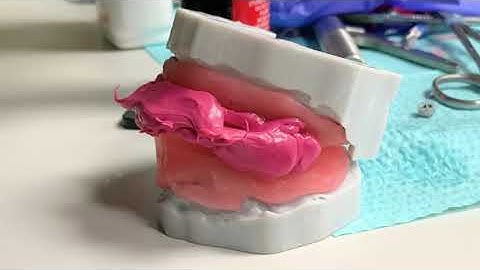 Securing the Framework for Bite Registration