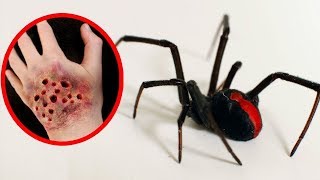7 Arañas Mas Venenosas Del Mundo