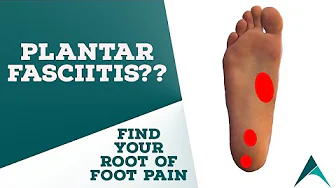 FIX PLANTAR FASCIITIS (Education-Stretching-Massaging-Exercises)