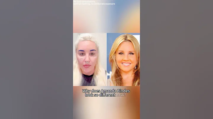 Why does Amanda Bynes looks so different now?#amandabynes #face #shorts #usa