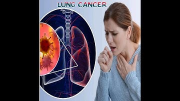 lung Cancer 10th Class Biology Ch#10 L#9 Biology  Lecture With Usman Ansari