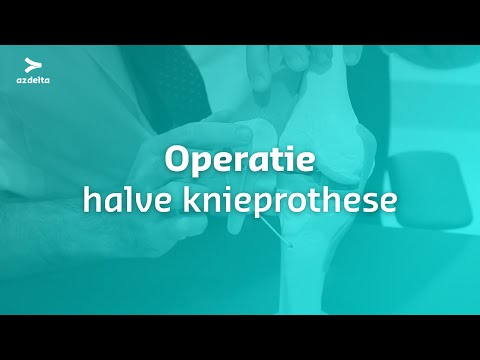 Video: Uw Dagelijkse Leven Na Vervanging Van De Knie