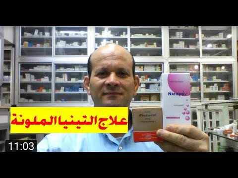 علاج التينيا الملونة  