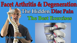 Facet Arthritis & Degeneration (The Hidden Disc Pain) Best Exercises - Dr Mandell