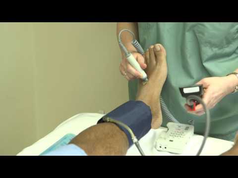 Video: Cara Mengambil Ankle Brachial Index: 14 Langkah (dengan Gambar)
