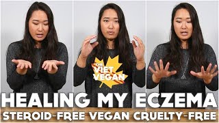 Healing My Eczema [ Steroid-free, Vegan & Cruelty Free ] ft. BetterHelp