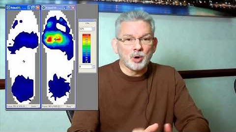 How In-Shoe Pressure Mapping Changed My Practice