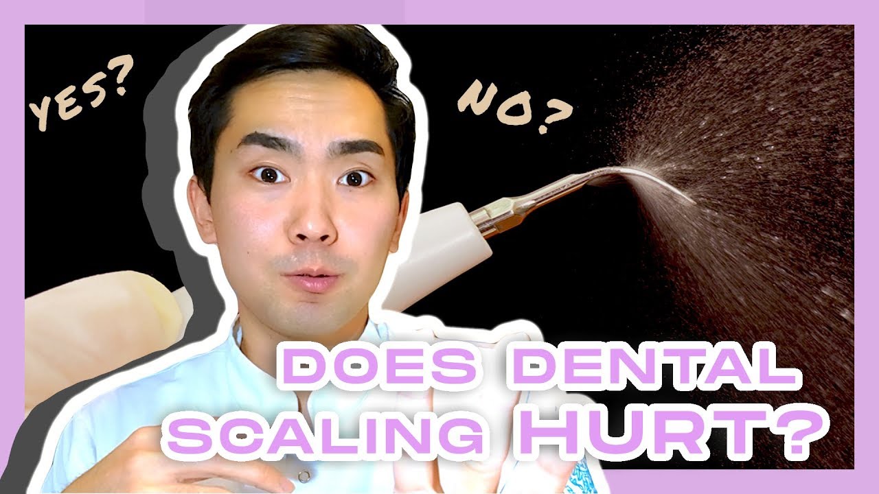 Dose Dental Scaling Hurt? How Does Dental Scaling Feel? YouTube