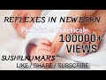 Neonatal Reflexes - Reflexes in a Newborn