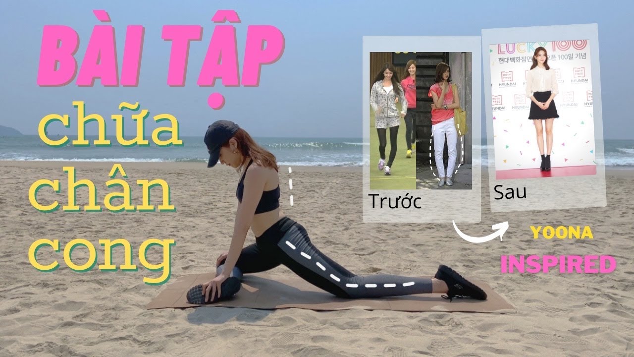 Exercises On How To Fix Bow Legs? (Inspired By Yoona) - Youtube