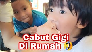 Cara Mencabut Gigi Yang Sudah Goyang | Cara Mencabut Gigi Anak Agar Tidak Sakit