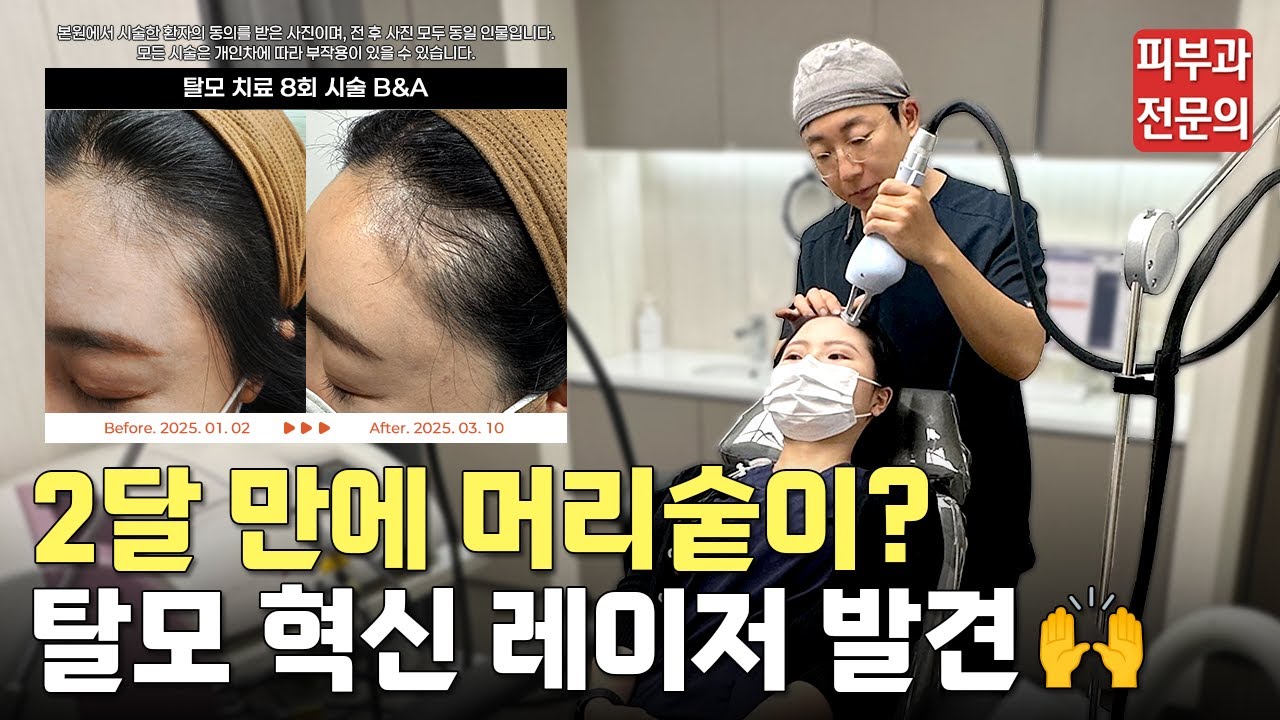 탈모 샴푸 안쓰셔도 됩니다!🤗ㅣ탈모 레이저, 탈모 예방, 여성탈모, 탈모병원, 탈모치료제, 탈모치료