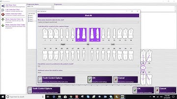 Training: Apteryx XVWeb: Creating a Progression in XVCapture