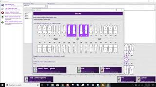 Training: Apteryx XVWeb: Creating a Progression in XVCapture