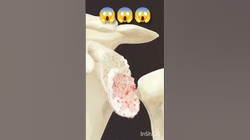 Start exploring a suite of 3D procedure videos in Complete Anatomy