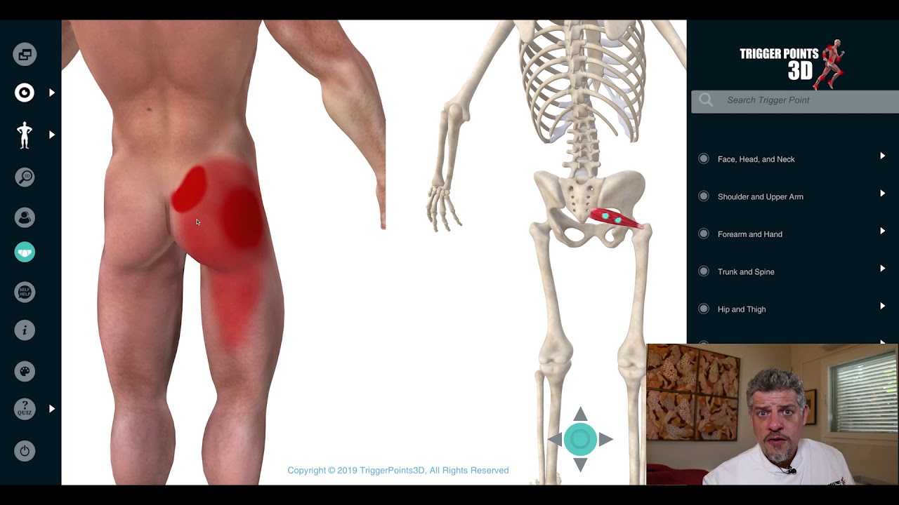 Piriformis - Trigger Point of the Week