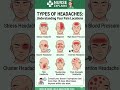 Where Does It Hurt? How to Identify Different Headaches! 💆♀️🚨 #shorts
