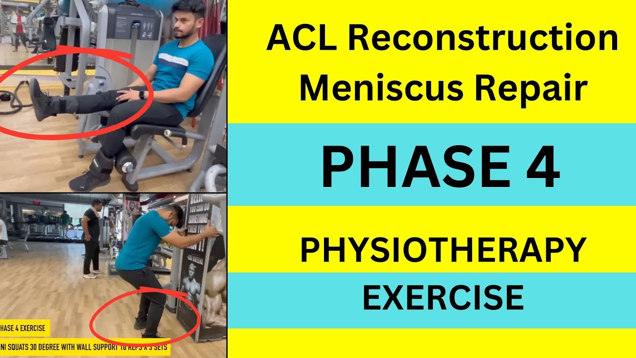 ACL Reconstruction and Meniscus Repair I Phase 4 Physiotherapy and ...