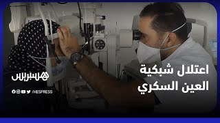 اعتلال شبكية العين السكري.. الدكتور زكرياء الجبار يعرف بالمرض ويوضح أسبابه وطرق علاجه
