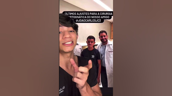Olha esse rapaz fez Cirurgia pra DIMINUIR o QUEIXO ! O MAIOR QUE JÁ VI !