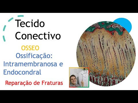 Tecido ósseo ( Ossificação: Intermembranosa , Endocondral e Reparação de Fraturas).  AULA 30