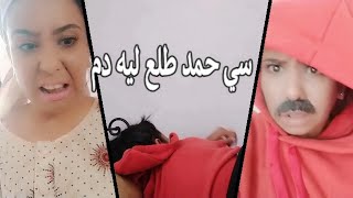 درت مقلب ف راجلي سي حمد حسنت ليه بلا ما/طلع ليه دم