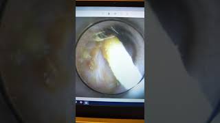 【耳掃除・耳かき動画】毛の塊&ねばねばが奥にいた！取るとこだけショート動画