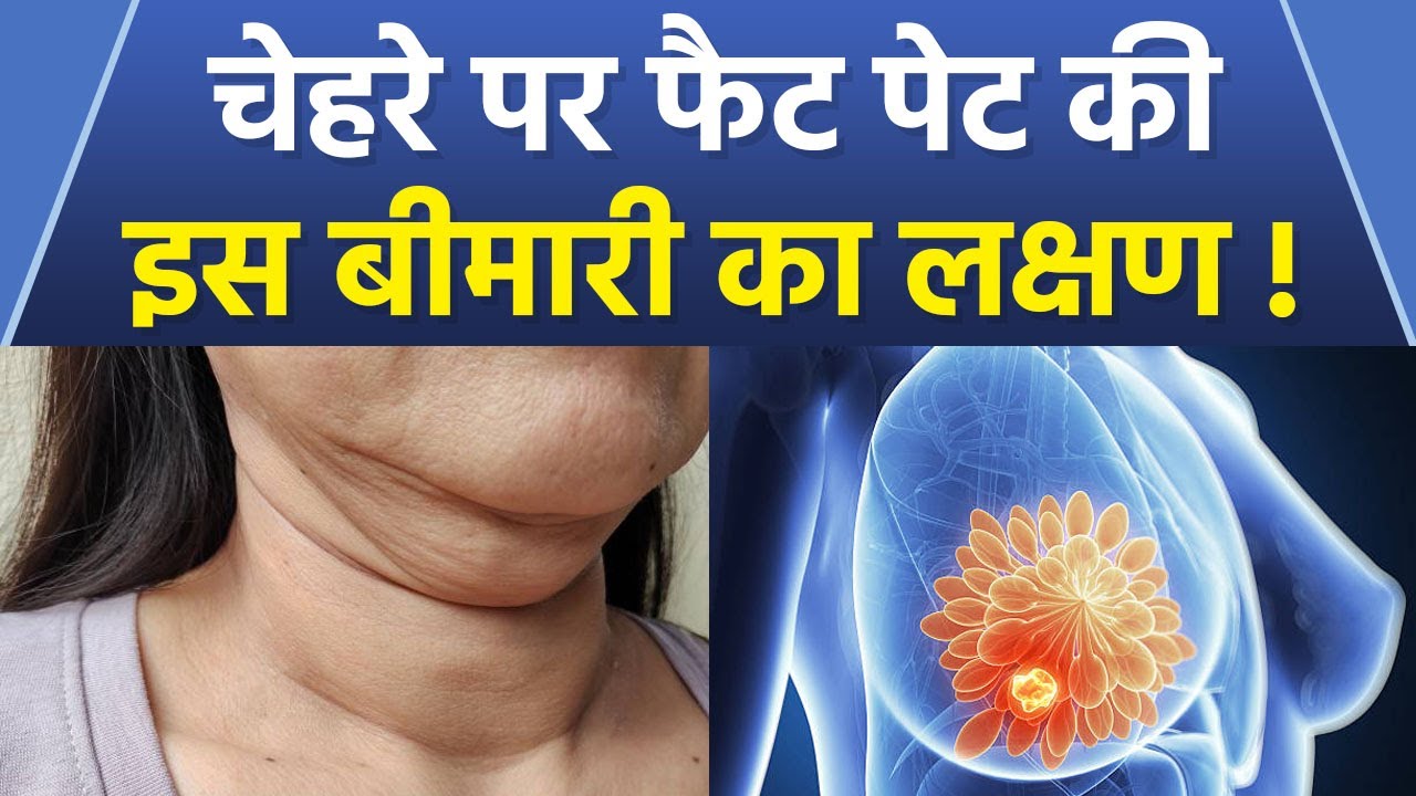 चेहरे पर फैट होना पेट की गंभीर बीमारी का लक्षण Face Par Fat Kyu Hota