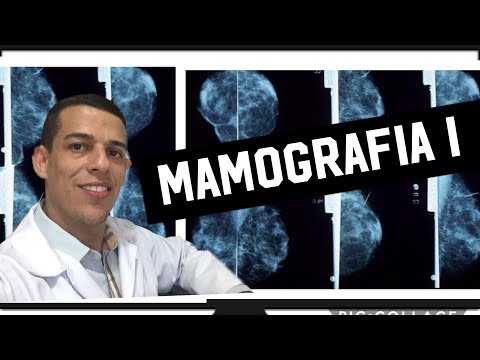 Vídeo: Imagens De Mamografia: Compreendendo Seus Resultados