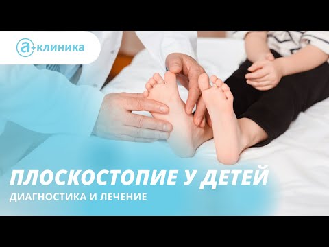 Плоскостопие у детей. Диагностика и лечение