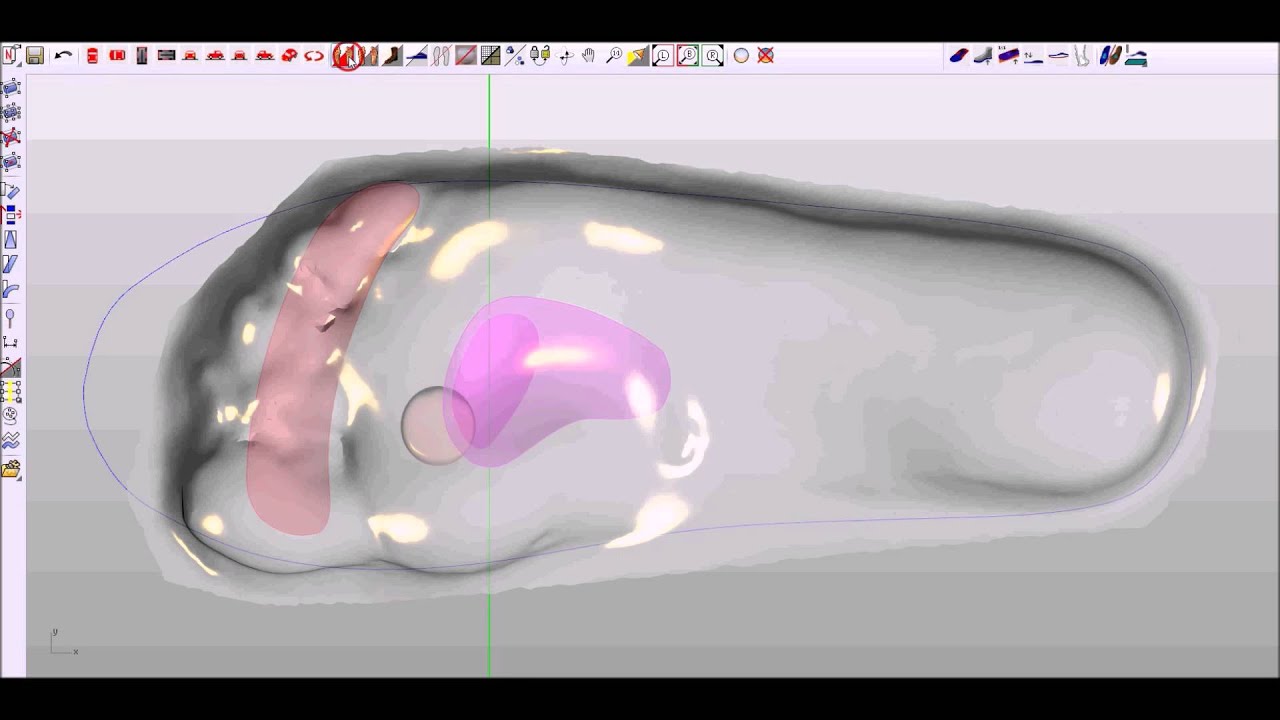 Ortowear 3D insole modeling