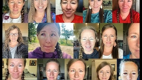 Strabismus Surgery Recovery in One Minute!