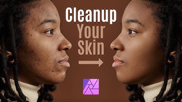CLEAN UP AND SMOOTHEN YOUR SKIN | PHOTO RETOUCHING | AFFINITY PHOTO FOR IPAD TUTORIAL