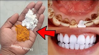 The secret that dentists don&#39;t want you to know: Removes tartar and whitens teeth in 2 minutes